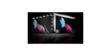 LG Electronics 55QNED87 (photo supp. n°16)