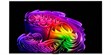 LG Electronics OLED55G6 (photo supp. n°1)