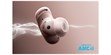 Soundcore Liberty 5 Pro Rose (photo supp. n°1)