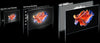LG Electronics 75QNED99 - EasyLounge - 19